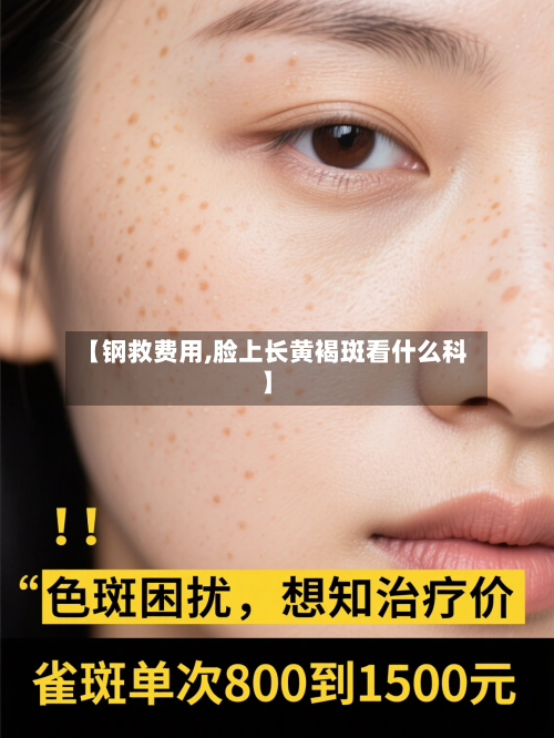 【钢救费用,脸上长黄褐斑看什么科】-第3张图片