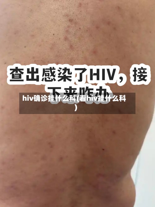 hiv确诊挂什么科(看hiv挂什么科)-第2张图片