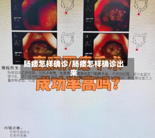 肠瘘怎样确诊/肠瘘怎样确诊出来