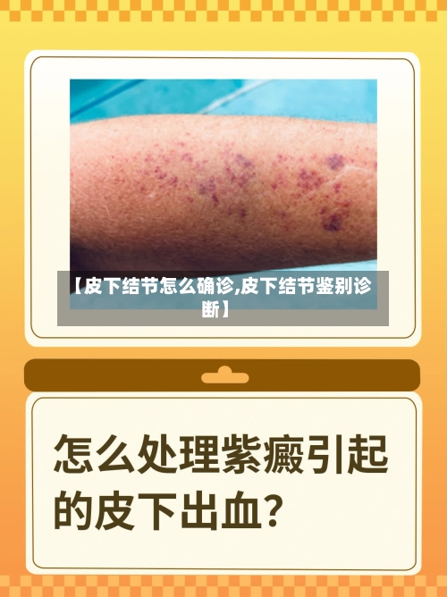 【皮下结节怎么确诊,皮下结节鉴别诊断】-第2张图片