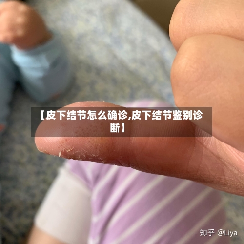 【皮下结节怎么确诊,皮下结节鉴别诊断】